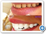 cosmetic-dentistry-06